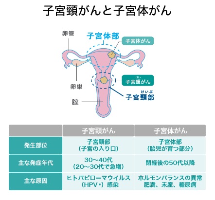 子宮 癌 の 末期 症状